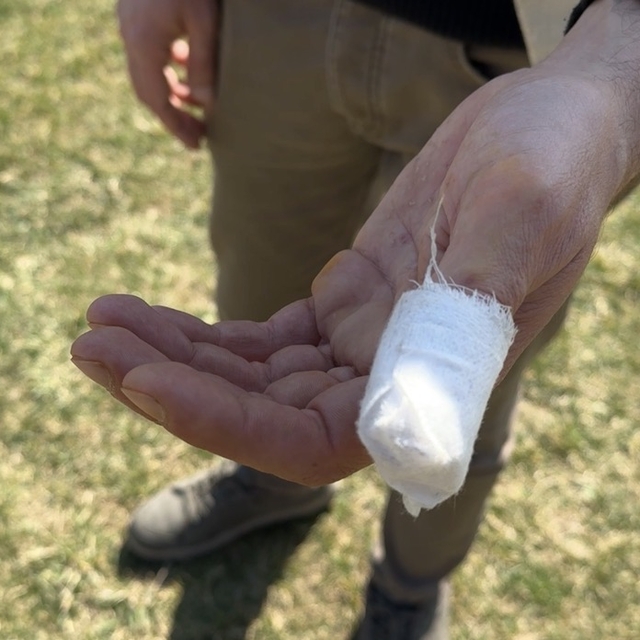 Parkta köpeği Şans ile gezerken başıboş pitbullun saldırısına uğradı