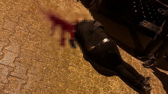 Sokakta yürürken tabanca ile başından vuruldu