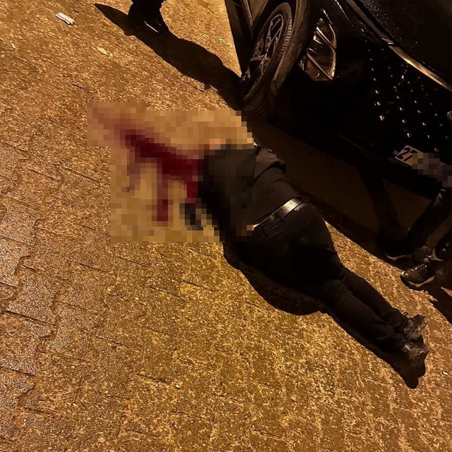 Sokakta yürürken tabanca ile başından vuruldu