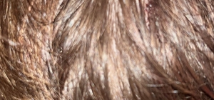 Kucağında bebeği ile darbedilen babanın oğlu, sokakta başına atılan taşla yaralandı