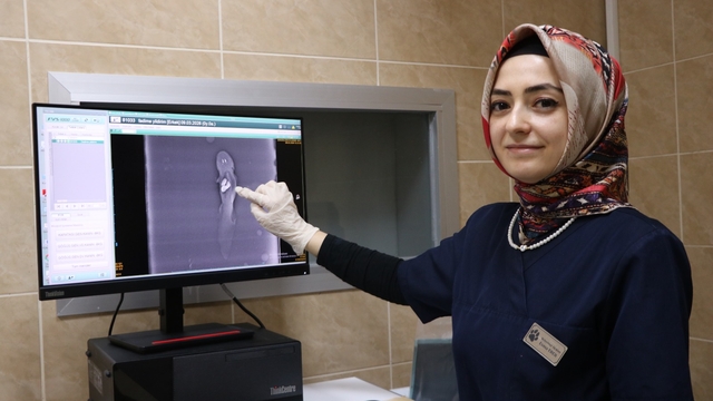 Akvaryumda taş yutan aksolotl balığı ameliyat edildi