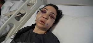 Anne ve oğlunun darp edilmesine ilişkin gözaltına alınan 3 şüpheliden 1'i tutuklandı