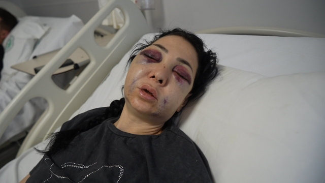 Anne ve oğlunun darp edilmesine ilişkin gözaltına alınan 3 şüpheliden 1'i tutuklandı