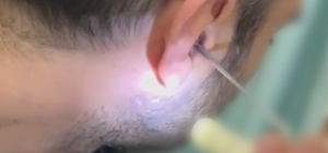 Kulağına gizlediği uyuşturucuyla yakalandı