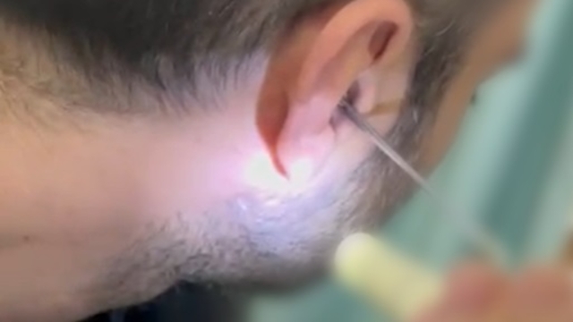 Kulağına gizlediği uyuşturucuyla yakalandı