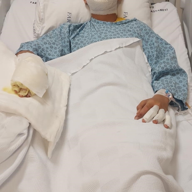 Ateşe benzin döktü, facianın eşiğinden döndü