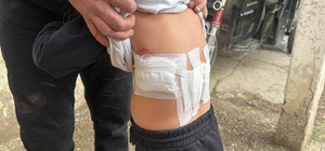 Saldırgan eşek evinin önünde oynayan 5 yaşındaki çocuğa kabusu yaşattı Eşeğin ısırması ve tekmelemesi sonrası ağır yaralanan çocuk hastaneye kaldırıldı