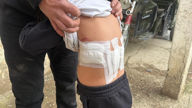 Saldırgan eşek evinin önünde oynayan 5 yaşındaki çocuğa kabusu yaşattı Eşeğin ısırması ve tekmelemesi sonrası ağır yaralanan çocuk hastaneye kaldırıldı - Afyonkarahisar Haberleri