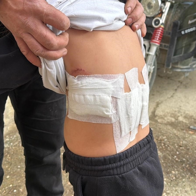 Saldırgan eşek evinin önünde oynayan 5 yaşındaki çocuğa kabusu yaşattı
Eşeğ...