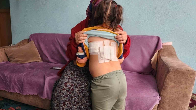 Evinin önünde oynayan çocuğa eşek saldırdı; o anlar kamerada (2)