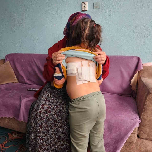 Evinin önünde oynayan çocuğa eşek saldırdı; o anlar kamerada (2)