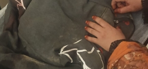 3 yaşındaki çocuğuna köpek saldıran baba: "Köpeğin çocuğumuzu bırakması için çok uğraştık" Kayseri’de başıboş köpeğin saldırısına uğrayan çocuk 3 operasyon geçirdi