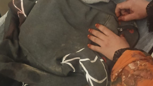 3 yaşındaki çocuğuna köpek saldıran baba: "Köpeğin çocuğumuzu bırakması için çok uğraştık"
Kayseri'de başıboş köpeğin saldırısına uğrayan çocuk 3 operasyon geçirdi