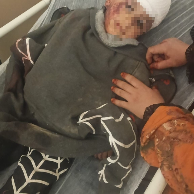 3 yaşındaki çocuğuna köpek saldıran baba: "Köpeğin çocuğumuzu bırakması içi...