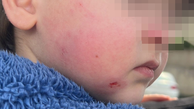 Kreşe bıraktığı çocuğunu darp edilmiş halde aldı
2 yaşındaki çocuk kreşte darp edildi