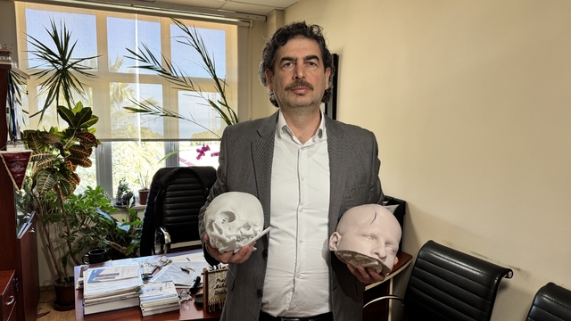 Yüzdeki şekil bozukluğu "3 boyutlu teknoloji"yle düzeltildi