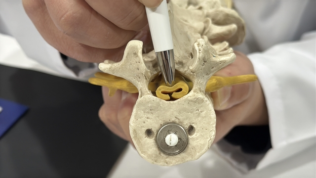 Beldeki gizli tehlike: Spinal stenoz
Bel fıtığıyla aynı belirtileri olan sinsi hastalık: Omurga daralması