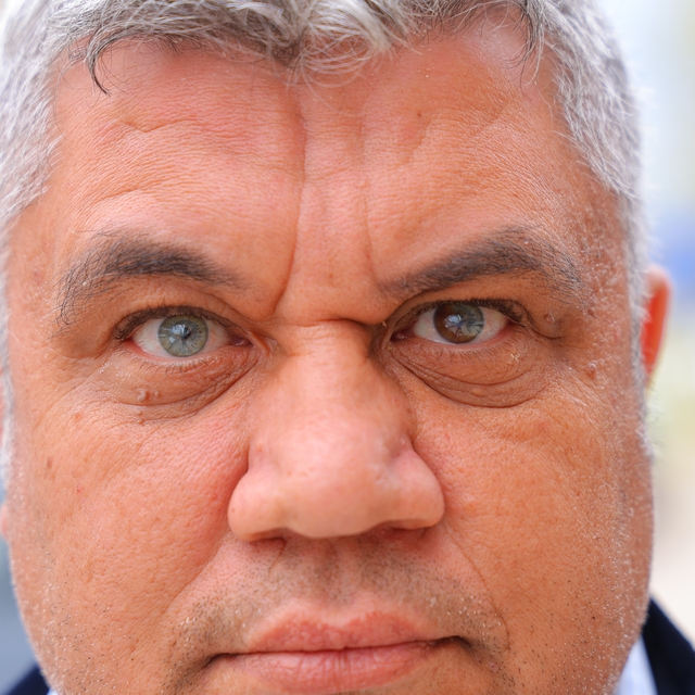 Kahramanmaraşlı adam 3 renkli gözleriyle görenlerin ilgisini çekiyor
Sol gö...