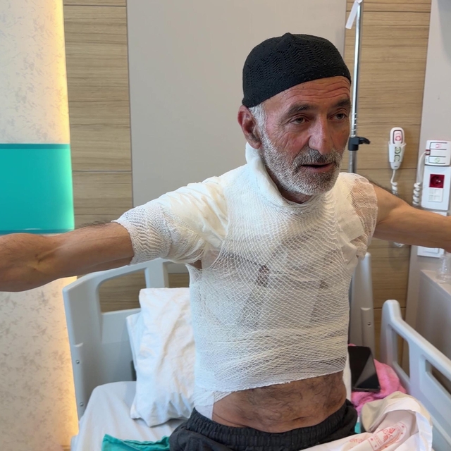 Güneş enerji sistemindeki arızayı tamir ederken üzerine dökülen sıcak su vü...