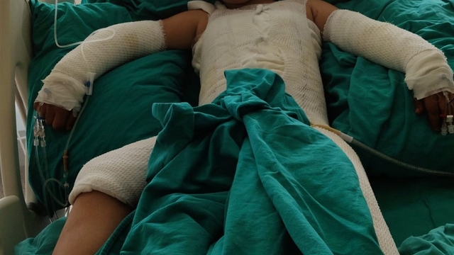 Trafoya takılan uçurtmasını almak isterken akıma kapılan çocuk ağır yaralandı; babadan ihmal iddiası