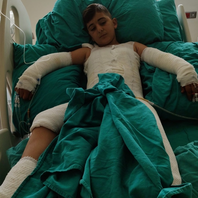 Trafoya takılan uçurtmasını almak isterken akıma kapılan çocuk ağır yaralan...