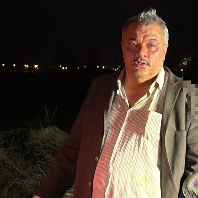 Polisten kaçan alkollü sürücü, polis aracında bineceği yeri beğenmedi
Kayse...