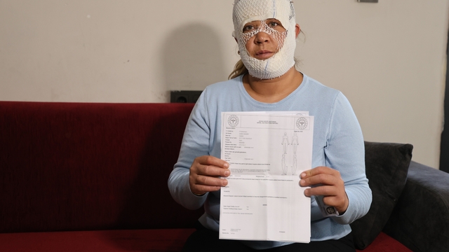 Güzelleşmek uğruna gittiği merkezde yüzü yandı
Yüzünde 2. derece yanık olan kadın:
"2 yaşındaki oğlum beni böyle görünce 'öcü' diyerek kaçıp düştü"
"Güzellik merkezinden ve işlemi yapan kadından şikayetçi oldum"
"Güzellik merkezi dalga geçerek telefonu kapattı"