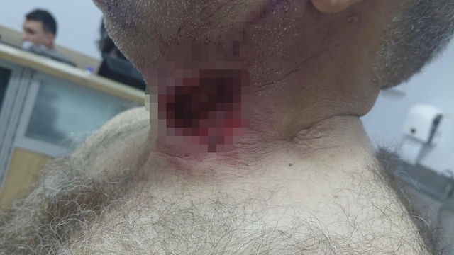 At sahibini boğazından ısırarak ağır yaraladı
