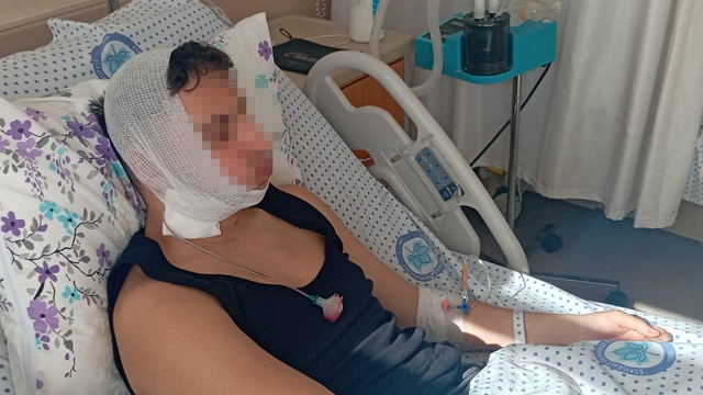Lise öğrencilerinin darp davası: Çenesi nasıl kırıldı anlam veremedik