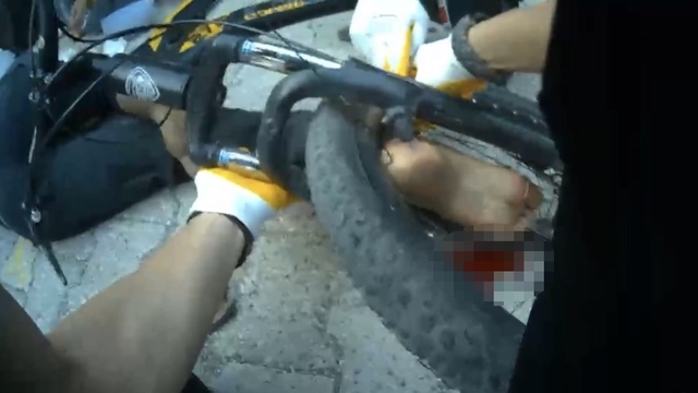 Osmaniye'de ayağı bisikletin tekerine sıkışan çocuk ekiplerce kurtarıldı