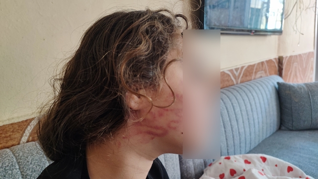 8 yaşındaki kızını darp eden çocuğun epilepsi hastası ablasını sokak ortasında dövdüğü iddiası
Çocuğu darp ettiği öne sürülen kadın ise darp etmediğini elinin değmiş olabileceğini söyledi