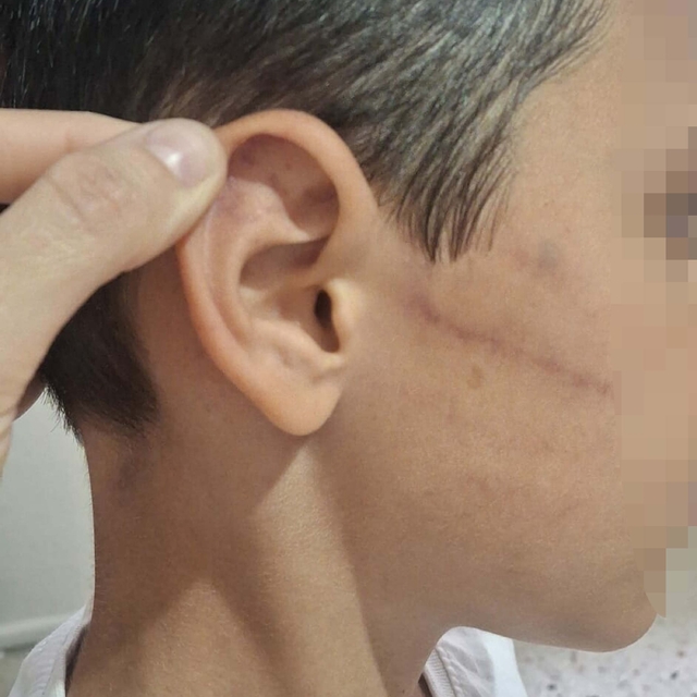Babasının darbettiği 12 yaşındaki çocuk koruma altına alındı