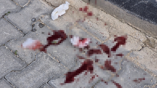 16 yaşındaki çocuk caddede bacağından bıçaklandı