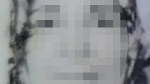 Boşanma aşamasındaki kocasının ağır yaraladığı kadının tedavisi sürüyor