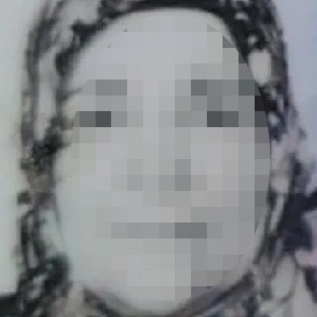 Boşanma aşamasındaki kocasının ağır yaraladığı kadının tedavisi sürüyor