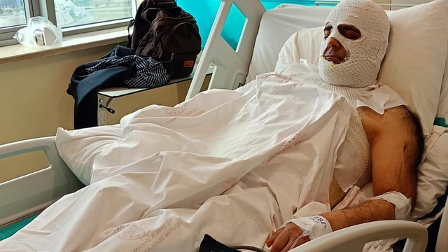 Yüksek gerilim akımına kapılan işçi 42 gündür hastanede