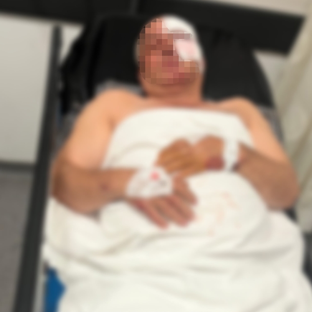 Motosiklet kazasında yaralandı, kardeşinin çarptığını iddia etti