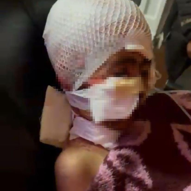 Narman Belediye Başkanı Aydemir Adem Kınalı'ya soruşturma izni