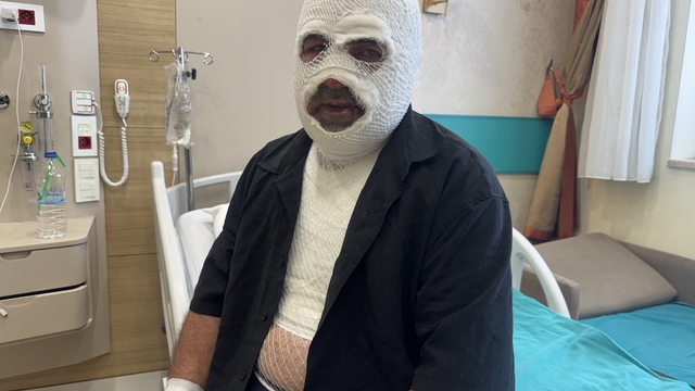 Hararet yapan araca acele müdahale ikinci derece yanığa neden oldu