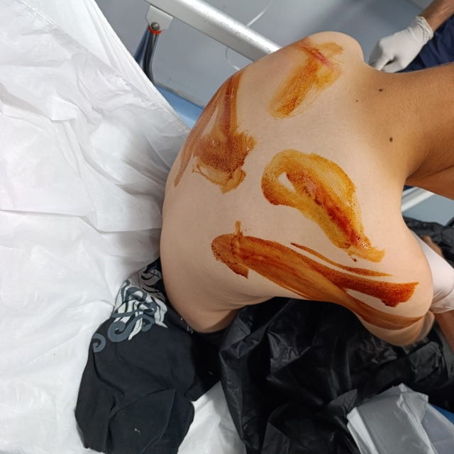 Şanlıurfa'da 11 yaşındaki çocuğa öldüresiye dayak
17 yaşındaki çocuk 11 yaş...