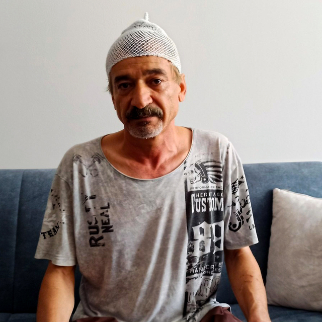 Çay içerken başına beton parçası düştü