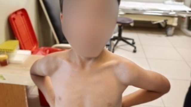 İnegöl'de kene alarmı
7 yaşındaki çocuğun göğsüne kene yapıştı