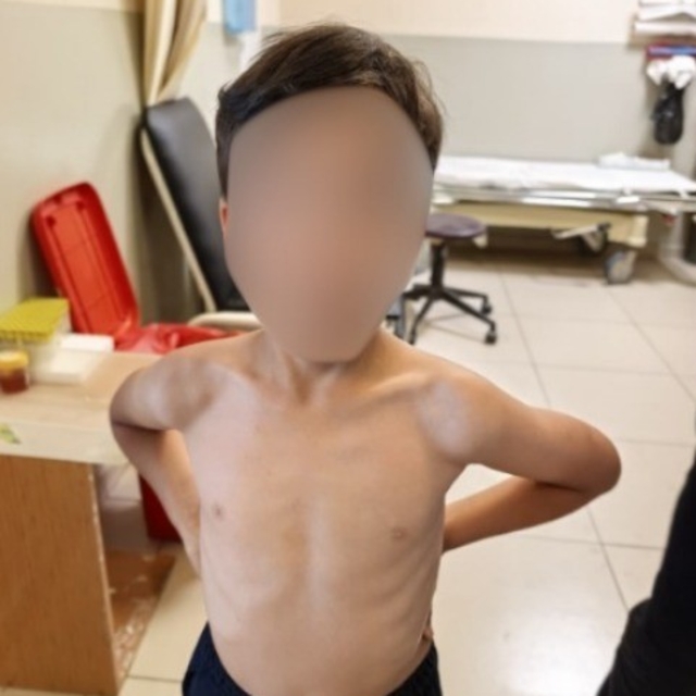 İnegöl'de kene alarmı
7 yaşındaki çocuğun göğsüne kene yapıştı