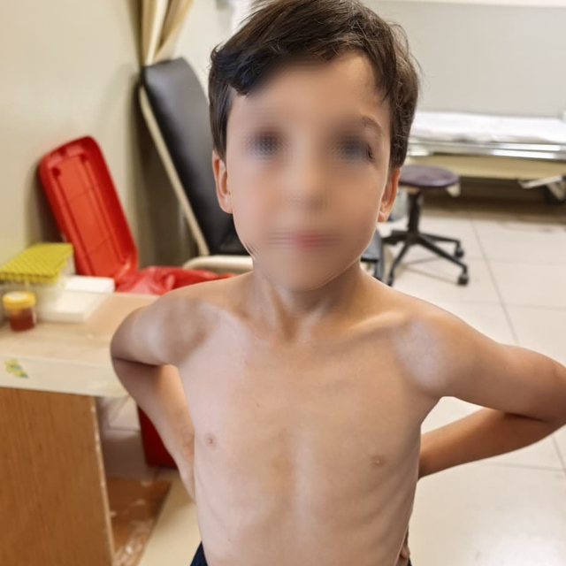 7 yaşındaki Mustafa'nın göğsüne kene yapıştı
