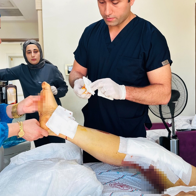 Siirt'te beton mikserine kaptırılan bacak başarılı ameliyatla kurtarıldı
