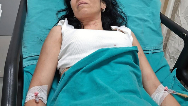 Boşanma aşamasındaki 16 yıllık eşi tarafından bıçaklanan Çiğdem, yaşam mücadelesi veriyor