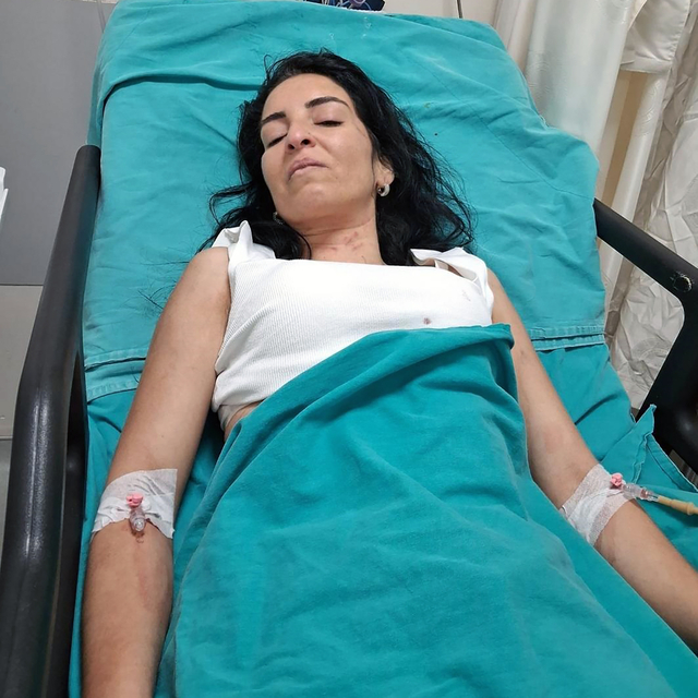 Boşanma aşamasındaki 16 yıllık eşi tarafından bıçaklanan Çiğdem, yaşam müca...