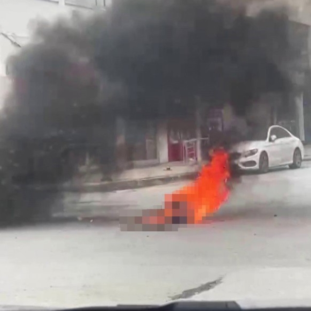 Üzerine benzin dökerek kendini yakan zihinsel engelli şahıs, 9 gün sonra ya...