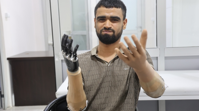Demirin elektrik tellerine değmesiyle hayatı kararan Muhammed, 3 milyon TL değerindeki protez bacağına ve 2 biyonik koluna kavuştu