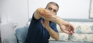 Otizmli oğluyla doğa gezisi sırasında sahipli köpeklerin saldırısına uğradı...